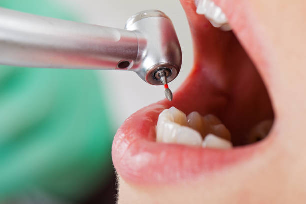 Best Broken Tooth Emergency  in Deer Lodge, MT